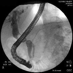 Рис. 1. Рентген-фото выявленной патологии