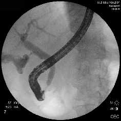 Рис. 1. Рентген-фото выявленной патологии