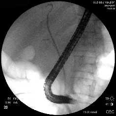 Рис. 2. Наиболее часто выполняемые эндоскопические вмешательства