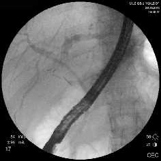 Рис. 2. Наиболее часто выполняемые эндоскопические вмешательства
