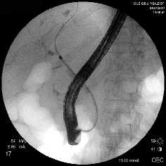 Рис. 2. Наиболее часто выполняемые эндоскопические вмешательства