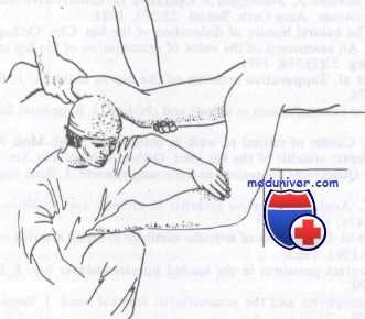 вывих бедра