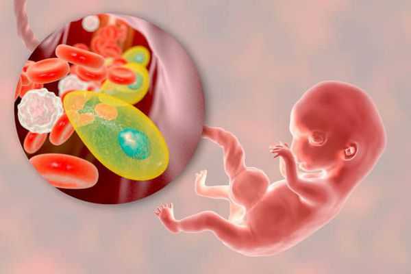 Внутриутробное инфицирование токсоплазмами