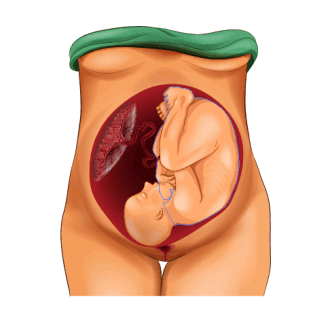 Головное предлежание плода