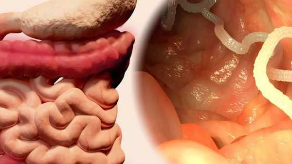 Свиной цепень в кишечнике