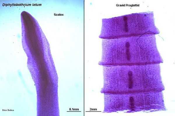 Головка и тело паразита