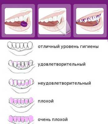 Индикация уровеня гигиены