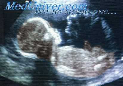 ведение беременности