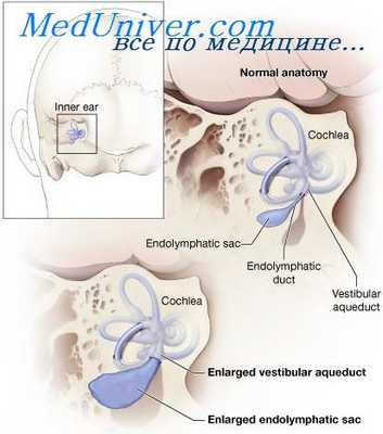внутреннее ухо