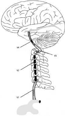 Рис. 1. ПА и ее четыре сегмента (V1, V2, V3, V4)