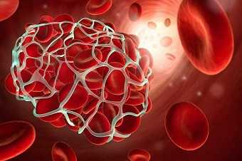 Растворимые фибрин-мономерные комплексы