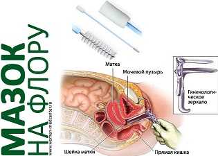 Взятие мазка