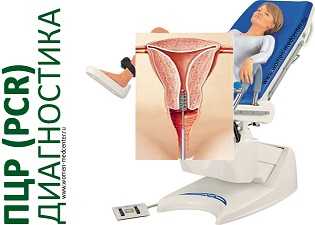 Диагностика ДНК