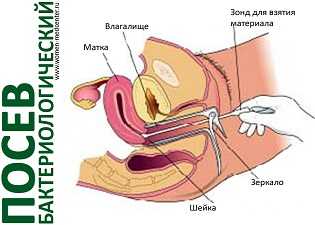 Как берут бакпосев флоры