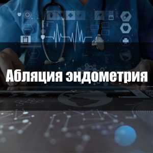 Абляция эндометрия
