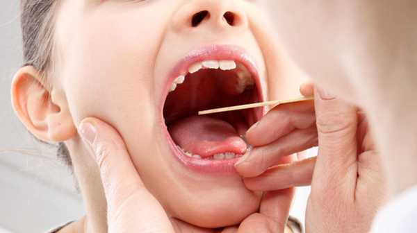 Удаление аденоидов