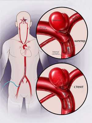 587684758674857648788725254515