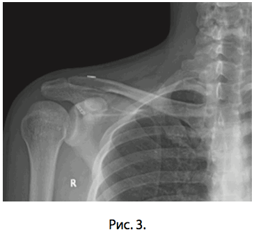 Рис. 3