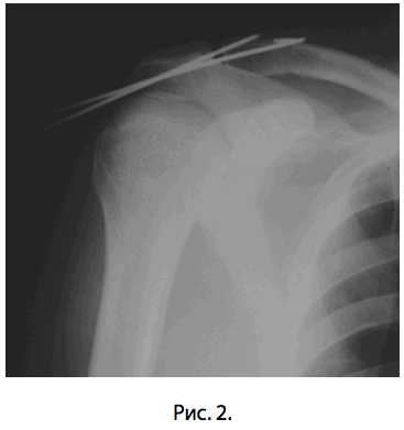 Рис. 2.