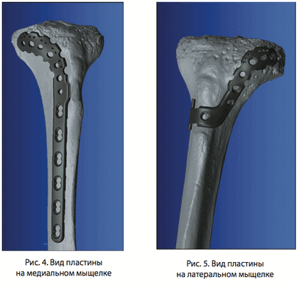Рис. 4 5. Вид пластины