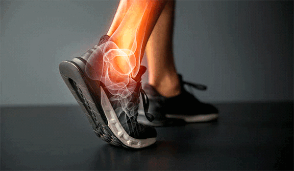 Лечение ахиллова сухожилия