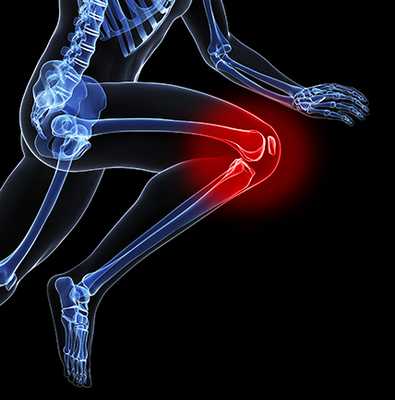 Боль в колене при эндопротезирование коленного сустава