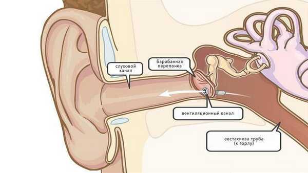 Миринготомия уха - что за операция и как проходит?