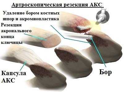akrom-klyuchichniy.jpg