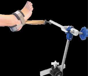 Артроскопическая пластика связки голеностопного сустава