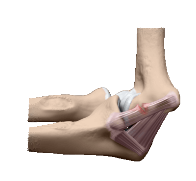 Травма связок локтевого сустава