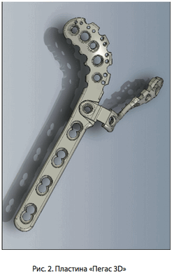 Рис. 2. Пластина Пегас 3D