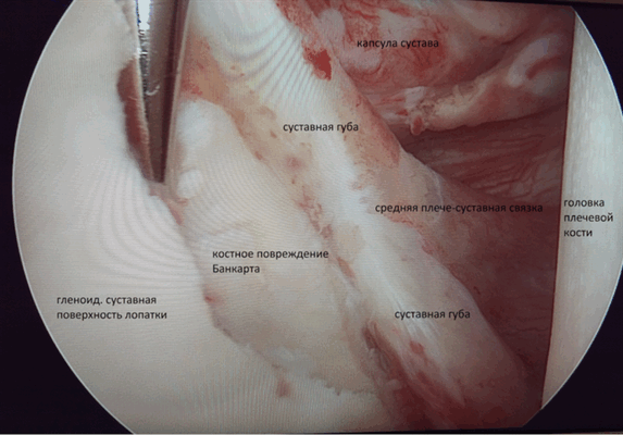 коленный сустав