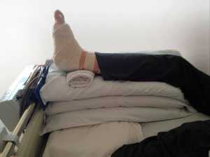 Возвышенное положение стопы