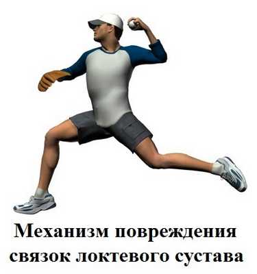 механизм повреждения связок локтевого сустава
