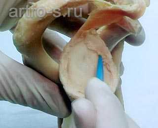 Анатомический препарат с демонстрацией строения суставной губы.