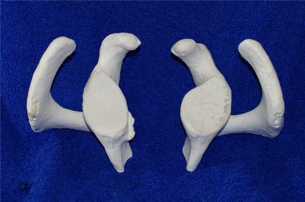 Костный Банкарт