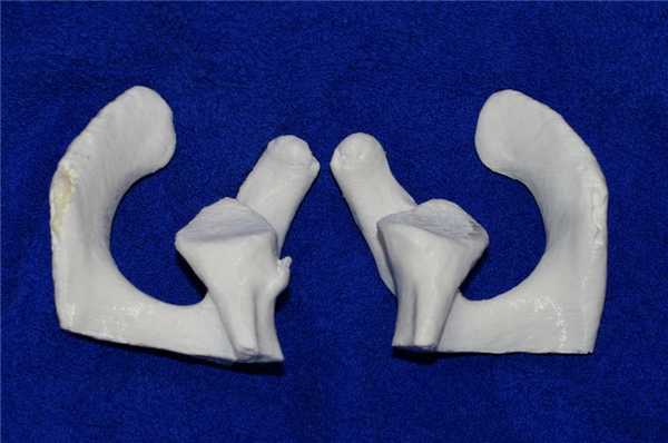 Костный Банкарт 