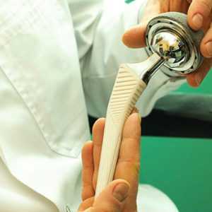 Искусственный сустав бедра