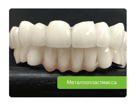 металлопластмассовый протез
