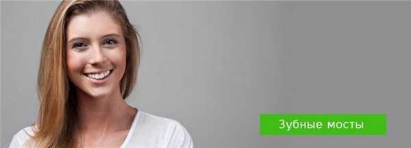 Мостовидные протезы