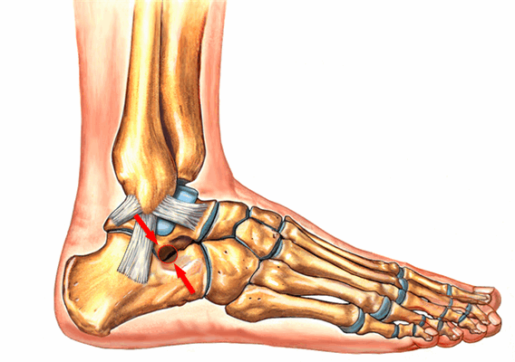 мобилизация голеностопного сустава и суставов стопы