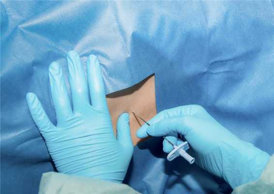 Осложнения местной анестезии: о чем нужно помнить