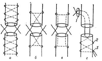 Рис. 1. Схематическое изображение различных видов внутриствольного сухожильного шва (пунктиром показан шовный материал внутри сухожилия): а — по Кюнео (сухожилие прошито сначала в поперечном направлении, затем крестообразно в виде шнуровки); б — по Блоху — Бонне (сухожилие прошито сначала в поперечном направлении, затем крестообразно); в — по Розову (сухожилие прошито сначала в поперечном направлении, затем вдоль оси); г — по Баннеллу с разгрузкой проксимального отрезка сухожилия (1 — пуговица, временно фиксирующая шов, 2 — съемный внутриствольный шов, 3 — петля для последующего удаления шва).