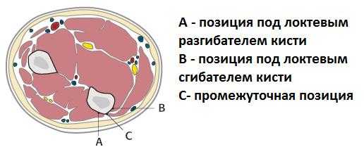 перелом локтевой кости анатомия
