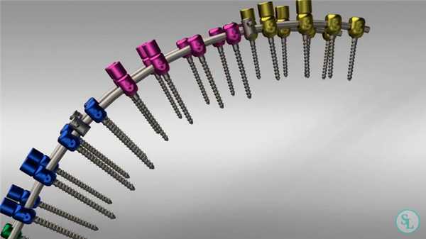 Способ Котреля-Дюбуссе