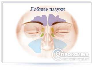 Трепанопункция лобной пазухи