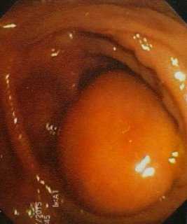 Описание: IMG_20160522_191318 (1)