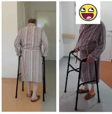 после эндопротезирования тазобедренного сустава