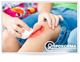 Глубокая рана у ребенка