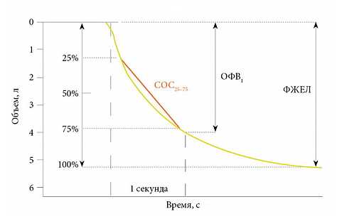 Спирограмма форсированного выдоха